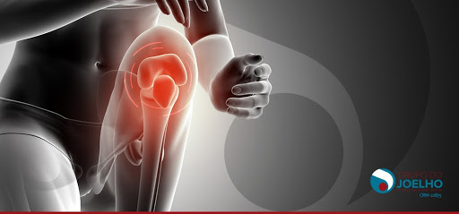 Artrose de joelho: causas, sintomas e tratamento