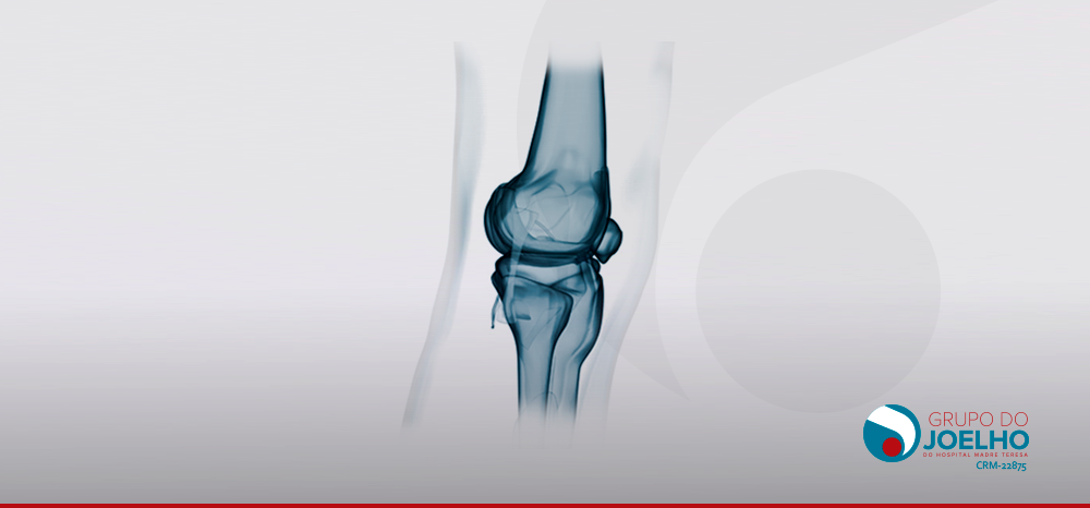 Exames do joelho: quando são indicados?