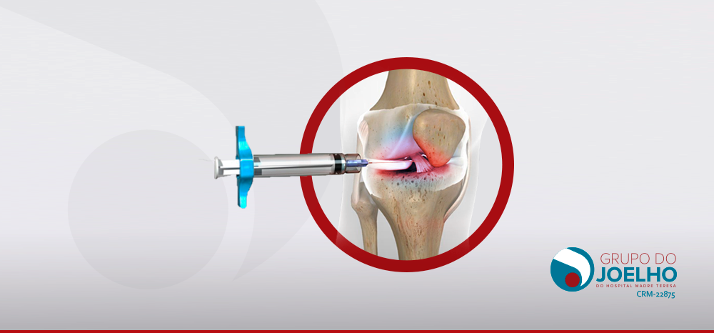 Quando a punção do joelho é indicada?